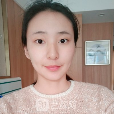 上海伊莱美朱迪双眼皮怎么样?亲身体验实例一览