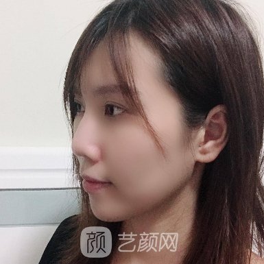 昆明吴氏嘉美隆鼻靠谱吗?医院实力及招牌实例一览