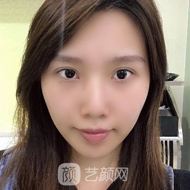 昆明吴氏嘉美隆鼻靠谱吗?医院实力及招牌实例一览