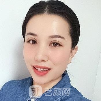 许莲姬双眼皮好贵？多少钱？医生简介+双眼皮真人实例图