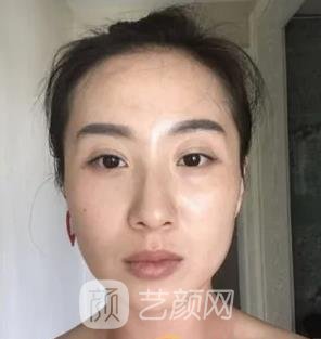 武汉第一医院整形美容科正规吗？拉皮谁做的好？价格表