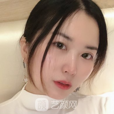 宁夏华美整形美容医院除皱怎么样?亲身体验实例展示