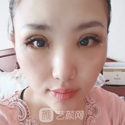 广州健丽做双眼皮怎么样?医院实力及实例曝光