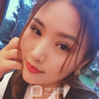 广州健丽做双眼皮怎么样?医院实力及实例曝光