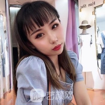 郑州孟明星给我做坏了眼睛？修复之后才知道有多美丽