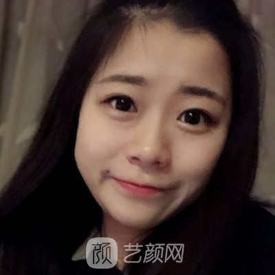 广州美咖林丰医生隆鼻技术怎么样?医生实力及实例曝光