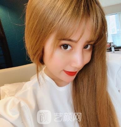 赵鹏隆鼻实例,术后从侧面看鼻子的弧度特别优美