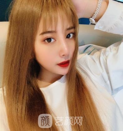 赵鹏隆鼻实例,术后从侧面看鼻子的弧度特别优美