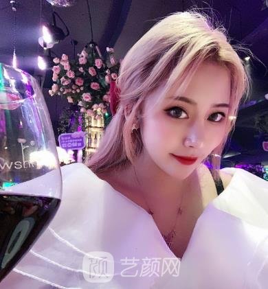 赵鹏隆鼻实例,术后从侧面看鼻子的弧度特别优美