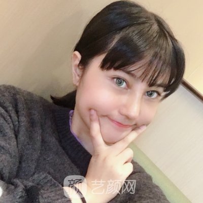 上海华美李健医生隆鼻风格公开|附体验成果图