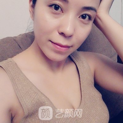 上海伊莱美整形医院硅胶隆胸怎么样？全新体验实例曝光