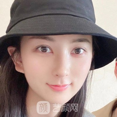 衡阳爱思特医疗美容医院口碑怎么样?全新隆鼻实例集中一览