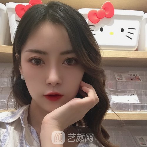 深圳市人民医院整形外科面部脂肪填充实例公开|美观又自然