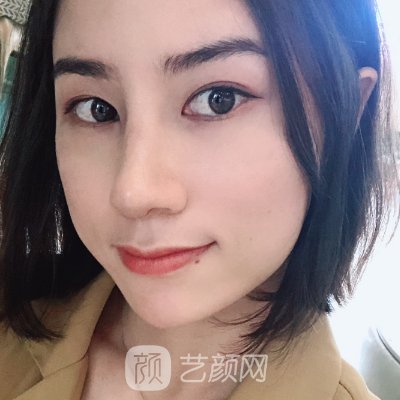 北京炫美是正规医院吗?隆鼻成果图出炉|成果自然美观