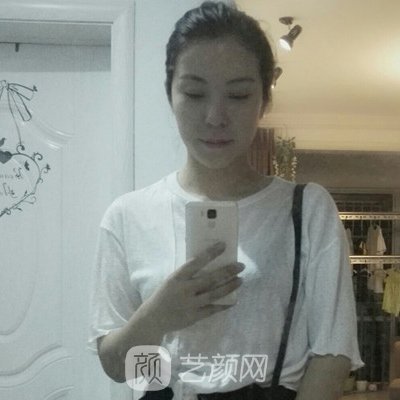 重庆华美美容医院隆胸实例公开|亲测体验细节展示