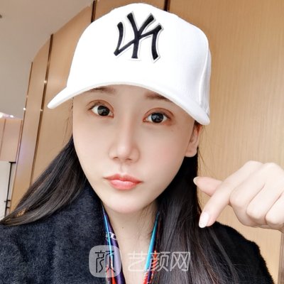 北京叶子整形美容医院正规吗?新版双眼皮整形实例曝光