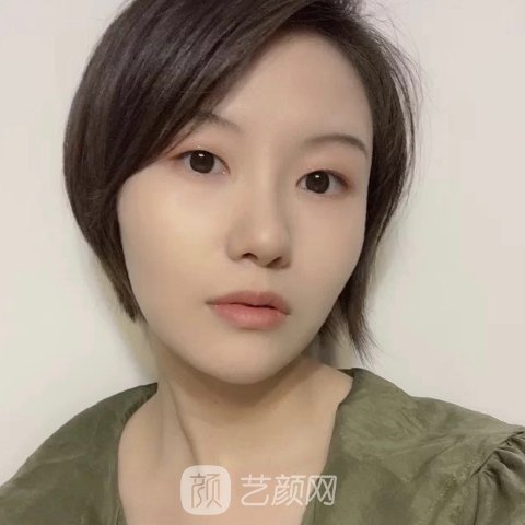 南京光尔美整形医院光子嫩肤实例公开|成果自然美光