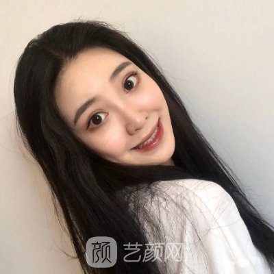 广州百莲凯整形医院除皱抗衰实例公开|成果自然美观