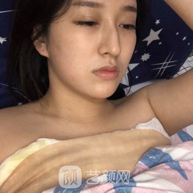 宁波美莱隆胸成果怎么样?医院实力及实例一览