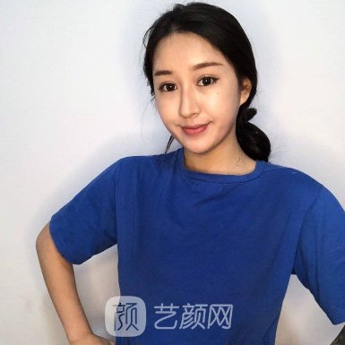 宁波美莱隆胸成果怎么样?医院实力及实例一览