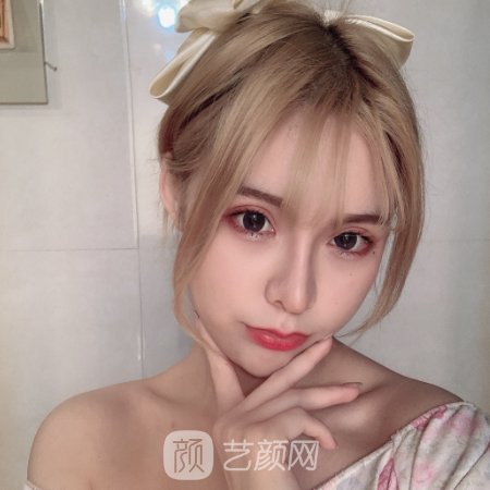 深圳市人民医院面部脂肪填充成果怎么样?2023体验实例公开