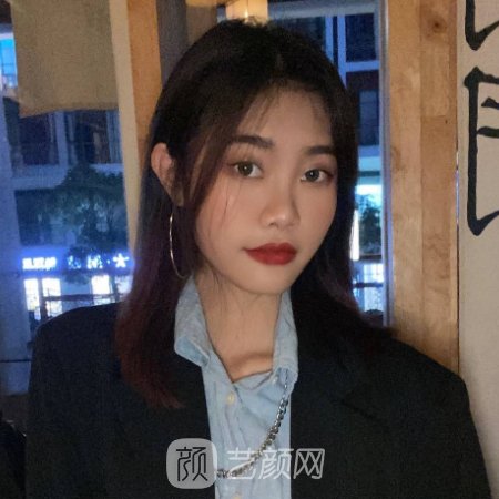 南昌虞美人医疗美容医院口碑怎么样?2023光子嫩肤实例一览