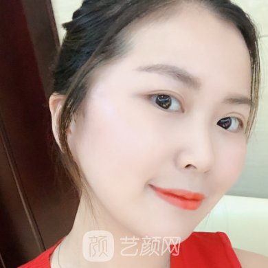 昆明华美美莱整形医院怎么样?新版注射除皱实例公开