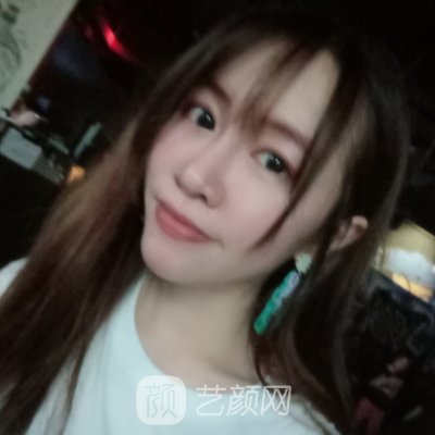 上海美莱整形医院口碑怎么样?全新玻尿酸面部填充实例一览