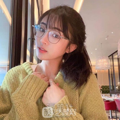 成都美枢郭英宁的双眼皮怎么样？全新体验实例出炉