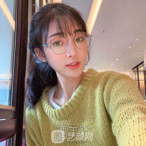 成都美枢郭英宁的双眼皮怎么样？全新体验实例出炉