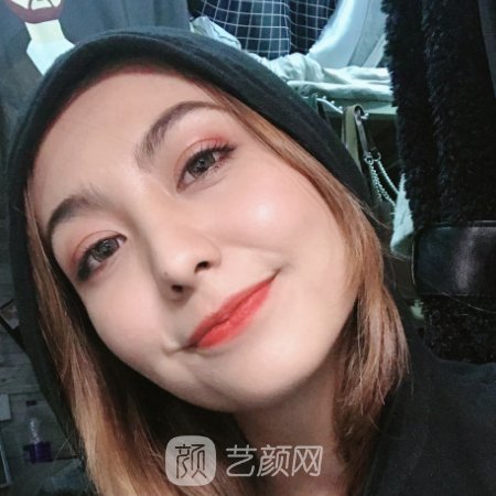 广州中科美医疗美容医院口碑怎么样?崭新面部提升实例出炉