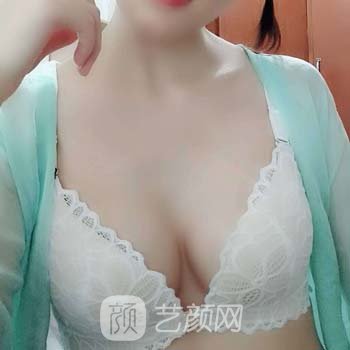 广州美莱隆胸实例，正规的整形机构打造性感的魔鬼身材