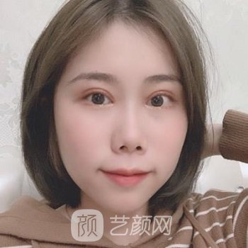 博美医院做双眼皮怎么样？多少钱？医生介绍+双眼皮实例