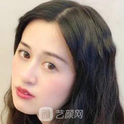 杭州同荣丽格整形医院正规吗？全新面部脂肪填充实例出炉