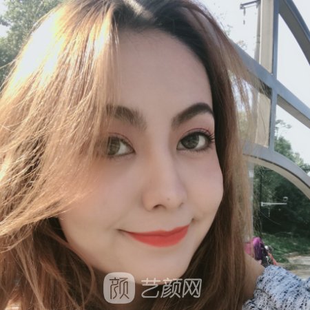 海南韩美医学美容医院口碑怎么样?2023面部提升实例一览