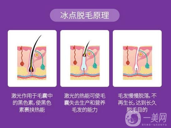 脱毛全攻略，拒绝毛手毛脚