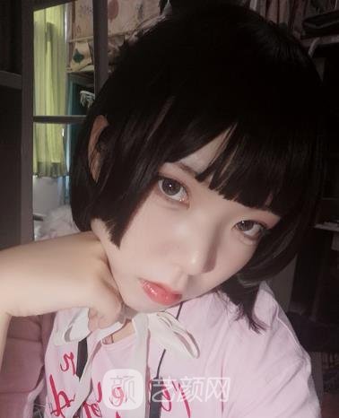 上海杨君毅磨骨实例,大方脸变成标准瓜子脸~