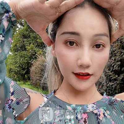 成都美绽美整形美容医院怎么样?全新注射除皱实例展示