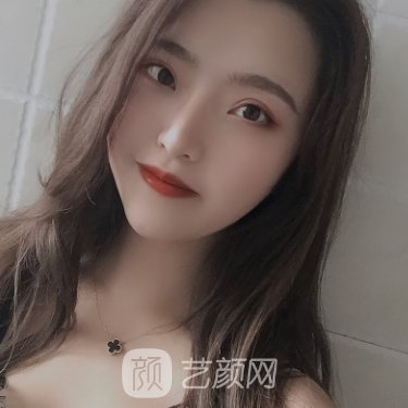 云南华美美莱美容医院正规吗?2023隆鼻实例公开