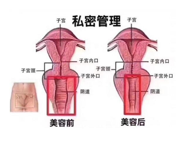 长沙中山医院怎么样?做小阴唇手术好不好?