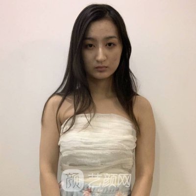 北京第三医院隆胸实例公布|2023体验实例图集中一览