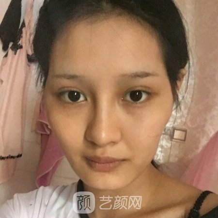 东莞美熙伊美医院正规吗？医生实力及实例一览