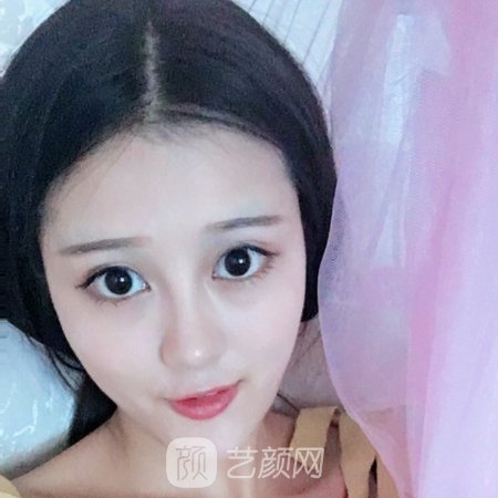 东莞美熙伊美医院正规吗？医生实力及实例一览