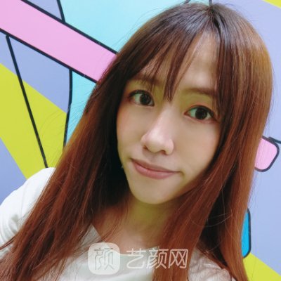 上海美姿整形医院正规吗?全新面部脂肪填充实例展示