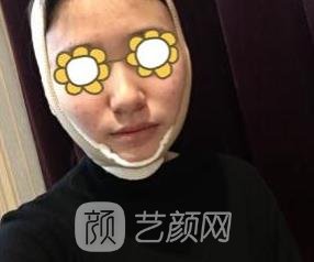 潘宝华磨骨实例，面庞看上去很精致，活脱脱的一个软萌美少女