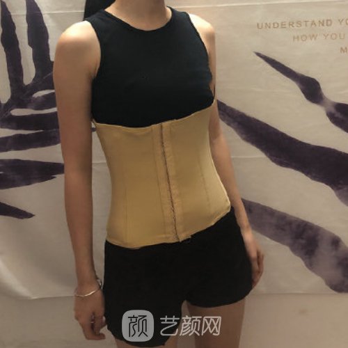 云南华美美莱整形医院吸脂实例出炉|成果无痕美观