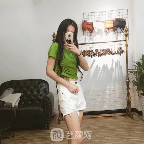 云南华美美莱整形医院吸脂实例出炉|成果无痕美观