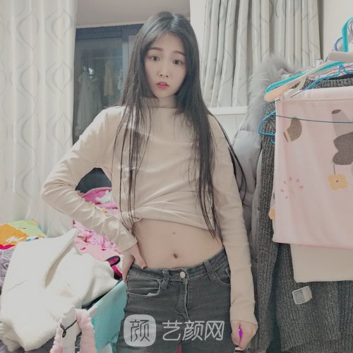 云南华美美莱整形医院吸脂实例出炉|成果无痕美观