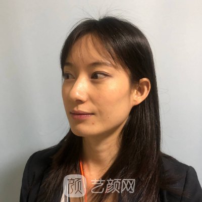 大连艾加艾整形是正规医院吗？新版光子嫩肤实例一览