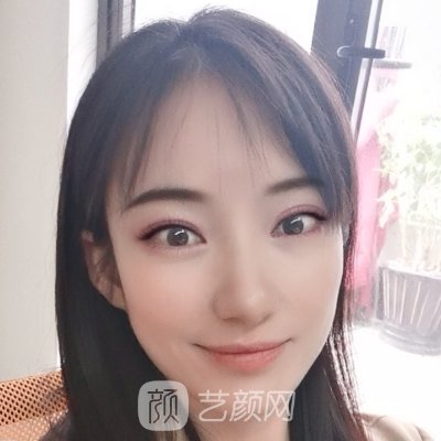 大连艾加艾整形是正规医院吗？新版光子嫩肤实例一览